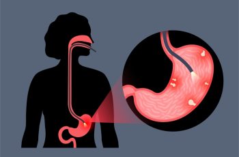 gastroscopy_13.jpg gastroscopy_13.jpg